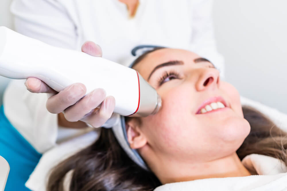 What is Radio Frequency (RF) Microneedling?