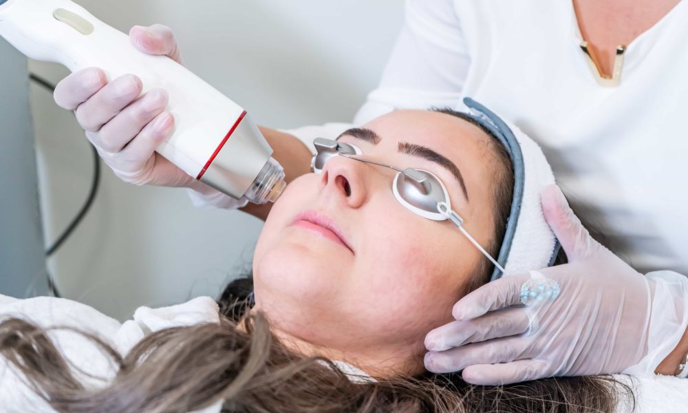 6 Things You Need to Know About Vivace® RF MICRONEEDLING